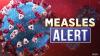 Three measles exposure locations identified in Oregon, OHA urging public to speak to health care provider