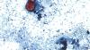 Michigan hits historic crisis level as parasitic cyclospora outbreak explodes past 1000 cases