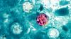 Cyclospora Outbreak Tops 2,640 Cases: Michigan Points to Lettuce or Salad Greens