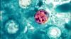 Cyclospora outbreak reaches Nebraska as health officials investigate source