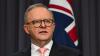 Albanese government to launch national AI office