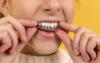 SG’s Medi Lifestyle agrees to buy 60% stake in Q & M Dental’s AI platform