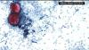 Cyclospora infections rise to four in New Mexico