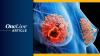 <![CDATA[Research Rewind: Phase 3 Breast Cancer Data Highlights From Q2 2026]]>