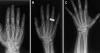 Medical X-rays taken in space for the first time