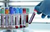 Fifth Measles Case of 2026 Confirmed by Wyoming Department of Health