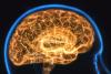 AI helps MS researchers see brain lesions