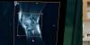 University of Florida lab utilizes community research to better understand osteoarthritis