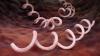 Australia Seeks to Reverse Surge in Syphilis Cases
