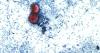 Oklahoma State Department of Health confirms 56 cyclosporiasis cases, 6 hospitalizations