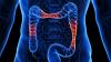 Groundbreaking Research: Gut Cells That Can Combat IBD