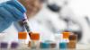Ireland unlikely to end HIV transmission by 2030 - report