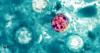 Cyclospora vs Food Poisoning: How to Tell the Difference