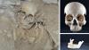 A window into Roman Malta: St Paul’s Catacombs skeleton to come to life