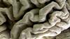 Study shows blood test can help identify people at high risk for Alzheimer's disease