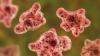 Pennsylvania Largely Avoids Foodborne Illness Outbreak