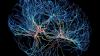 China Just Performed the World’s First Implant of a Commercial Brain-Computer Interface