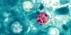 State confirms 4th case of cyclosporiasis in Hawaii-based military member