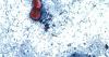 Missouri reports 216 cyclospora cases, a fivefold jump in one week