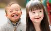Number of people with Down syndrome in Azerbaijan increased by 30 percent