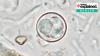 Parasite causing ‘explosive diarrhoea’: Why cyclospora is worrying doctors