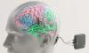 China performs the world's first commercial brain-chip implant, beating Neuralink
