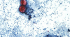 Cabarrus Health Alliance investigates reported cyclospora case