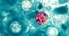 Florida cases of diarrhea-causing parasite nearly double; see numbers reported in each county