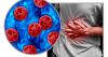 Cyclospora cases reported across South Florida could be lower than actual cases