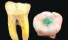 Ancient Maya used jade for dental therapeutic purposes, research reveals