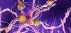 New Study Suggests THC and CBD Could Help Treat Agitation in Dementia Patients