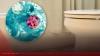 Missouri reports surge in Cyclospora parasite cases | Frequent, watery diarrhea is common symptom