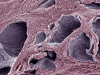 UK Clears First Precision Pill for BRCA-Mutated Prostate Cancer: NICE Now Decides