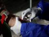 Pakistan Medical Association declares national public health emergency after 6,51,000 children miss routine immunisation