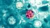 6 Albertans hit with parasitic illness, province says no link to U.S. outbreak found