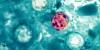 Cyclosporiasis cases rising nationwide, three cases reported in South Dakota