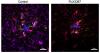 Two hours of sleep restored: UK researchers make Alzheimer’s breakthrough