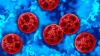 There are more cases of Cyclosporiasis that have been reported in Mississippi.