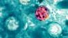 11 cases of Cyclosporiasis confirmed in Alabama: What health officials are saying