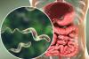 Cayman records one case of cyclosporiasis