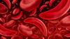 Miami-Dade Cyclospora Cases Surge As Monroe Reports First Infection