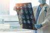 Scientists Find Drug That May Fight Alzheimer’s on Multiple Fronts