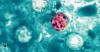 Cyclosporiasis outbreak spreads to Kentucky