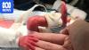 Researchers working on artificial placentas for premature babies