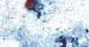 Foodborne illnesses at restaurant chains are rare but can sicken customers