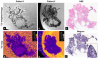 Israeli team wins grant for AI ovarian MRI