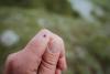 Free tool gives New Jersey towns daily tick risk scores as tick-related ER visits hit 10-year high