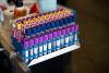 Blood Proteins Predict Faster Brain Aging in Older Black Adults, Study Finds