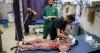 The number one health issue in Palestine is the Israeli occupation