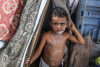 Chickenpox spreads among Palestinian children in Gaza, UN says as Israel destroys infrastructure